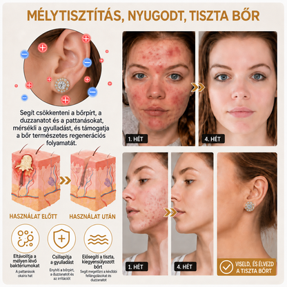 TIMNAMY® mágneses moissanit nyirokmasszázs fülbevaló: gyors eredmények, nincs szükség füllyukasztásra. Utolsó napi különleges ajánlat: 50% kedvezmény 💝💘5