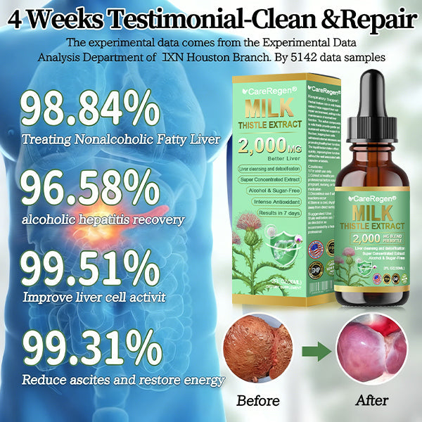 𝗢𝗳𝗳𝗶𝗰𝗶𝗮𝗹 𝗦𝘁𝗼𝗿𝗲:CareRegen® 𝗢𝗿𝗴𝗮𝗻𝗶𝗰 𝗠𝗶𝗹𝗸 𝗧𝗵𝗶𝘀𝘁𝗹𝗲 𝗘𝘅𝘁𝗿𝗮𝗰𝘁 𝗣𝗼𝘄𝗲𝗿𝗳𝘂𝗹 𝗟𝗶𝘃𝗲𝗿 𝗣𝗿𝗼𝘁𝗲𝗰𝘁𝗶𝗼𝗻 𝗗𝗿𝗼𝗽𝘀 🌿 𝐂𝐥𝐢𝐧𝐢𝐜𝐚𝐥𝐥𝐲 𝐩𝐫𝐨𝐯𝐞𝐧, 𝐡𝐢𝐠𝐡𝐥𝐲 𝐜𝐨𝐧𝐜𝐞𝐧𝐭𝐫𝐚𝐭𝐞𝐝 𝐟𝐨𝐫𝐦𝐮𝐥𝐚 𝐭𝐡𝐚𝐭 𝐝𝐞𝐭𝐨𝐱𝐢𝐟𝐢𝐞𝐬 𝐭𝐡𝐞 𝐥𝐢𝐯𝐞𝐫, 𝐫𝐞𝐥𝐢𝐞𝐯𝐞𝐬 𝗳𝗮𝘁𝘁𝘆 𝗹𝗶𝘃𝗲𝗿, 𝗵𝗲𝗽𝗮𝘁𝗶𝘁𝗶𝘀 & 𝗹𝗶𝘃𝗲𝗿 𝘀𝘁𝗿𝗲𝘀𝘀 — 𝗻𝘂𝗿𝘁𝘂𝗿𝗲 𝘆𝗼𝘂𝗿 𝗹𝗶𝘃𝗲𝗿, 𝗳𝗮𝘀𝘁𝗲𝗿 & 𝘀𝗮𝗳𝗲𝗹𝘆. 🌿