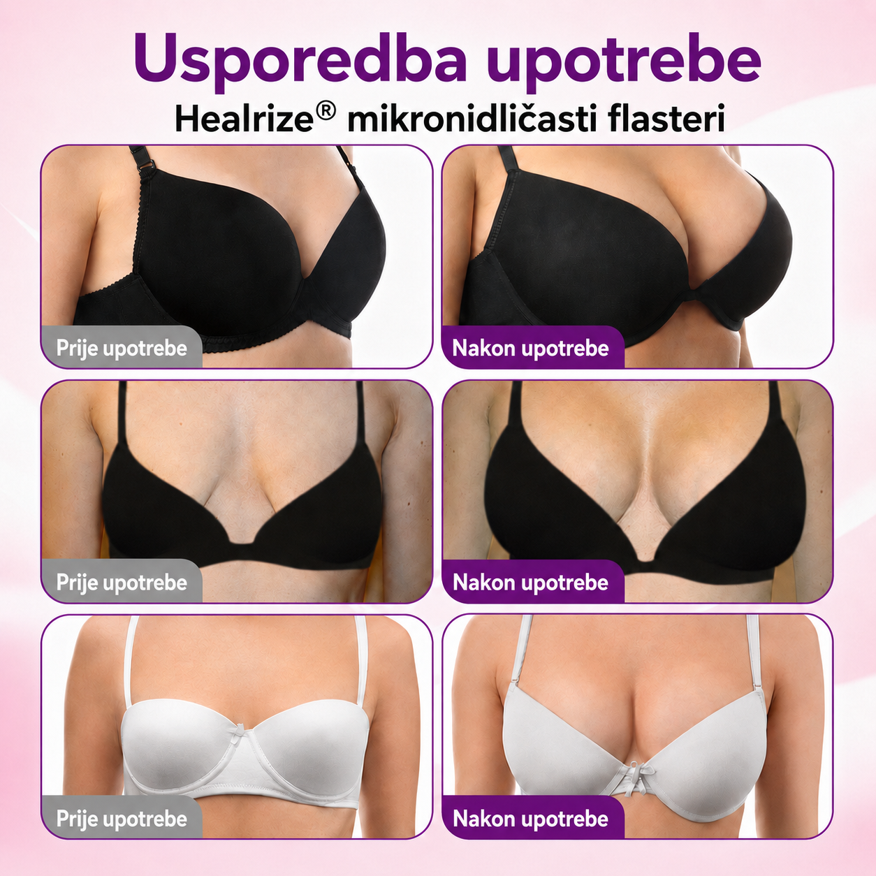 🚩Healrize®| Napredni nanomikroigličasti flaster za ciljano povećanje grudi👩‍⚕️👩‍🎓5