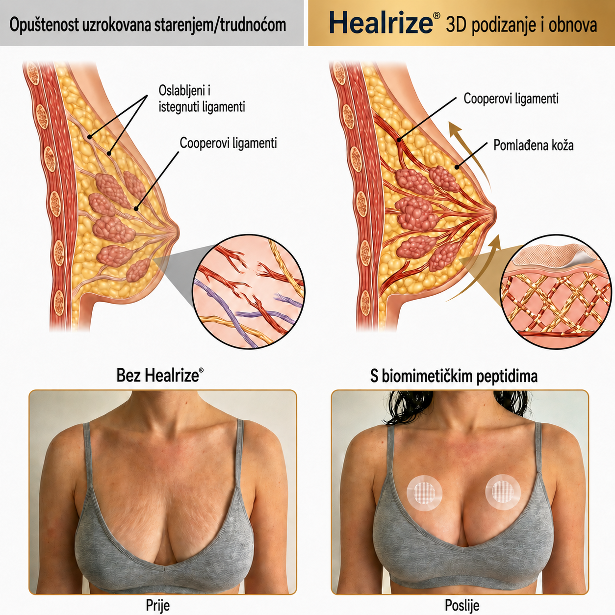 🚩Healrize®| Napredni nanomikroigličasti flaster za ciljano povećanje grudi👩‍⚕️👩‍🎓5